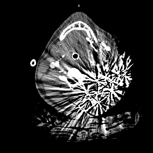 An external file that holds a picture, illustration, etc., usually as some form of binary object. The name of referred object is rmmj-3-3-e0016_Figure3.jpg